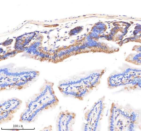  IHC analysis of EpCAM/Trop1 using anti-EpCAM/Trop1 antibody (M30950-1)