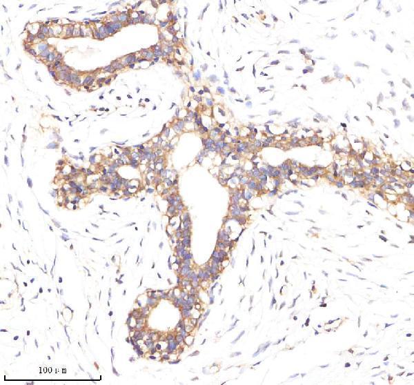 m30950 1 cd326 primary antibodies ihc testing 7