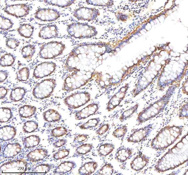m30950 1 cd326 primary antibodies ihc testing 8