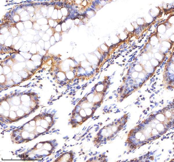 m30950 1 cd326 primary antibodies ihc testing 9