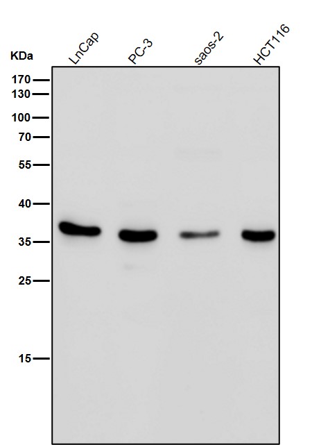 All lanes use the Antibody at 1:2K dilution for 1 hour at room temperature
