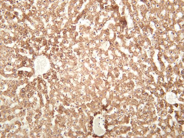 m31469 1 piezo primary antibodies ihc testing 1