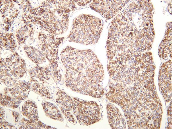 m31469 1 piezo primary antibodies ihc testing 2