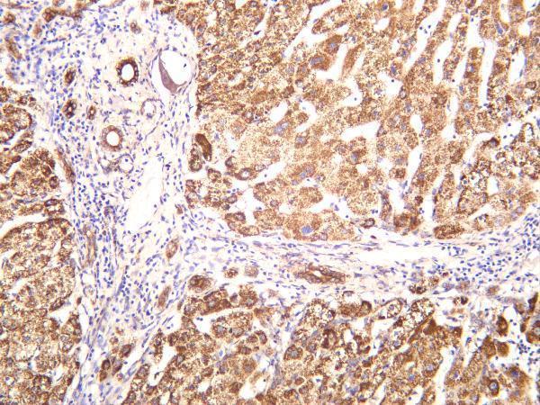 m31469 1 piezo primary antibodies ihc testing 3