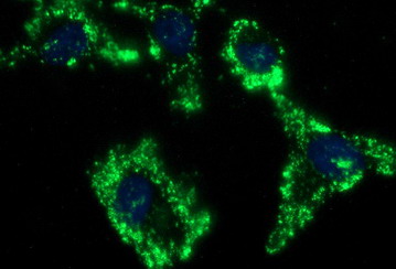 m31653 anti cybc1 mouse monoclonal antibody clone id oti3b5 if testing 2