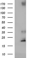 HEK293T cells were transfected with the pCMV6-ENTRY control (Left lane) or pCMV6-ENTRY C17orf62 (Right lane) cDNA for 48 hrs and lysed. Equivalent amounts of cell lysates (5 ug per lane) were separated by SDS-PAGE and immunoblotted with anti-C17orf62.