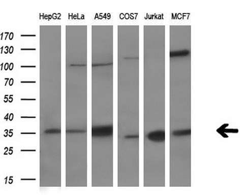 Western blot analysis of extracts (10ug) from 6 different cell lines by using anti-C21orf59 monoclonal antibody (1:200).