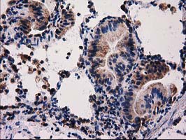 m31820 anti rtl8b mouse monoclonal antibody clone id oti1a6 ihc testing 2