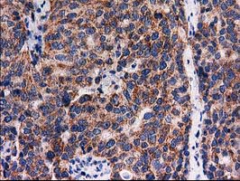 m31820 anti rtl8b mouse monoclonal antibody clone id oti1a6 ihc testing 3