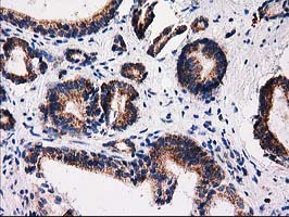 m31820 anti rtl8b mouse monoclonal antibody clone id oti1a6 ihc testing 4