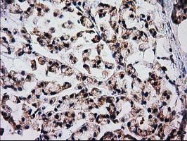 m31820 anti rtl8b mouse monoclonal antibody clone id oti1a6 ihc testing 5