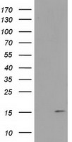 m31820 anti rtl8b mouse monoclonal antibody clone id oti1a6 wb testing 1