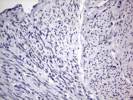 m31823 anti rtraf mouse monoclonal antibody clone id oti2a4 ihc testing 11