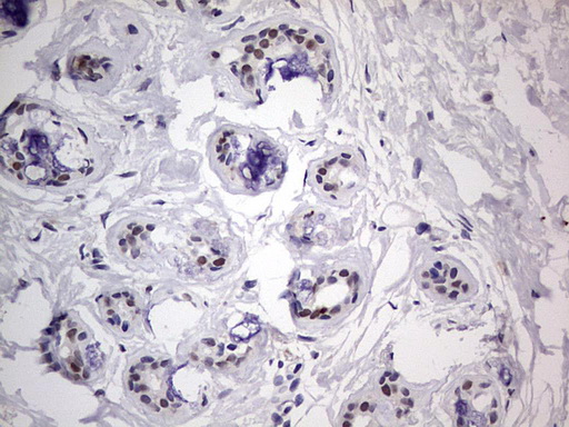 m31823 anti rtraf mouse monoclonal antibody clone id oti2a4 ihc testing 13