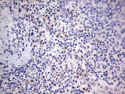 m31823 anti rtraf mouse monoclonal antibody clone id oti2a4 ihc testing 16