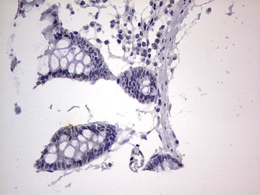 m31823 anti rtraf mouse monoclonal antibody clone id oti2a4 ihc testing 20