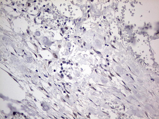 m31823 anti rtraf mouse monoclonal antibody clone id oti2a4 ihc testing 23