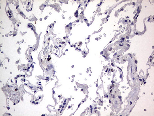 m31823 anti rtraf mouse monoclonal antibody clone id oti2a4 ihc testing 25