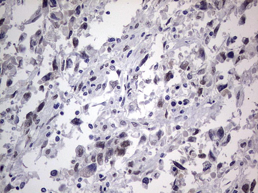 m31823 anti rtraf mouse monoclonal antibody clone id oti2a4 ihc testing 5