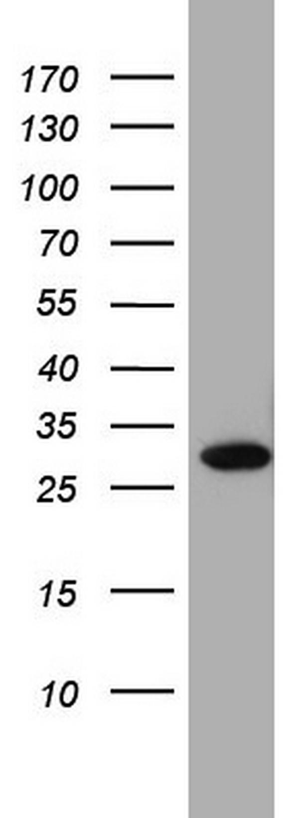 Western blot analysis of A549 cell lysate (35ug) by using anti-C14orf166 monoclonal antibody