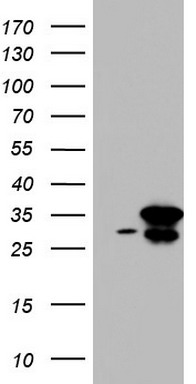 HEK293T cells were transfected with the pCMV6-ENTRY control (Left lane) or pCMV6-ENTRY C14orf166 (Right lane) cDNA for 48 hrs and lysed