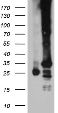 HEK293T cells were transfected with the pCMV6-ENTRY control (Left lane) or pCMV6-ENTRY C19orf52 (Right lane) cDNA for 48 hrs and lysed