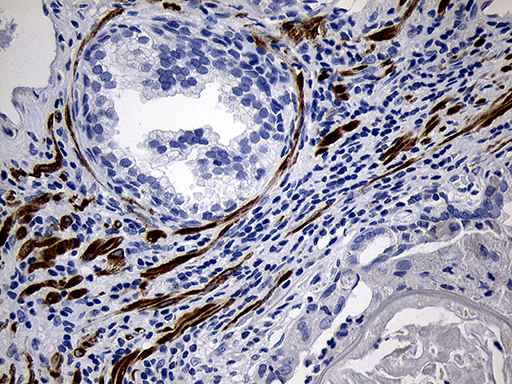 Immunohistochemical staining of paraffin-embedded Human prostate tissue within the normal limits using anti-C1orf111 mouse monoclonal antibody. (Heat-induced epitope retrieval by 1mM EDTA in 10mM Tris buffer (pH8.5) at 120°C for 3min