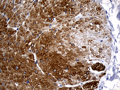 Immunohistochemical staining of paraffin-embedded Human bladder tissue within the normal limits using anti-C1orf111 mouse monoclonal antibody. (Heat-induced epitope retrieval by 1mM EDTA in 10mM Tris buffer (pH8.5) at 120°C for 3min