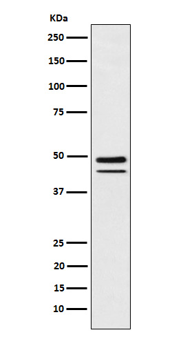 Western blot analysis of Brachyury expression in MUG-Chor1 (human sacral bone chordoma) cell lysate