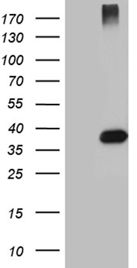 HEK293T cells were transfected with the pCMV6-ENTRY control (Left lane) or pCMV6-ENTRY HFE2 (Right lane) cDNA for 48 hrs and lysed