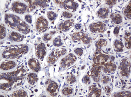 Immunohistochemical staining of paraffin-embedded Human breast tissue within the normal limits using anti-ATP5C1 mouse monoclonal antibody