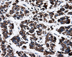 m32270 1 anti atp5f1b mouse monoclonal antibody clone id oti1b10 ihc testing 5