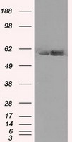 HEK293T cells were transfected with the pCMV6-ENTRY control (Left lane) or pCMV6-ENTRY ATP5B (Right lane) cDNA for 48 hrs and lysed