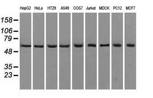 Western blot analysis of extracts (35ug) from 9 different cell lines by using anti-ATP5B monoclonal antibody