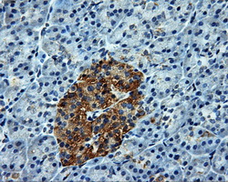 m32270 anti atp5f1b mouse monoclonal antibody clone id oti1f7 ihc testing 3