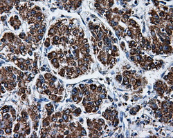 m32270 anti atp5f1b mouse monoclonal antibody clone id oti1f7 ihc testing 7