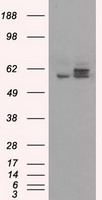 m32270 anti atp5f1b mouse monoclonal antibody clone id oti1f7 wb testing 1
