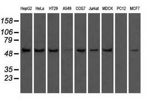 m32270 anti atp5f1b mouse monoclonal antibody clone id oti1f7 wb testing 2