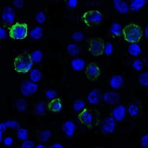 m32320 vsir primary antibodies if testing 3