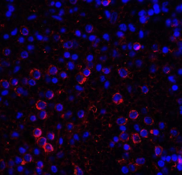 m32320 vsir primary antibodies if testing 5