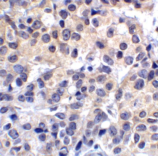m32320 vsir primary antibodies ihc testing 6