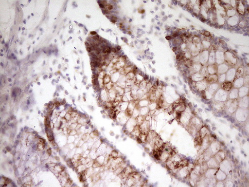 Immunohistochemical staining of paraffin-embedded Human colon tissue within the normal limits using anti-FIGF mouse monoclonal antibody
