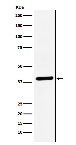 Western blot analysis of VEGFD expression in Caco-2 cell lysate