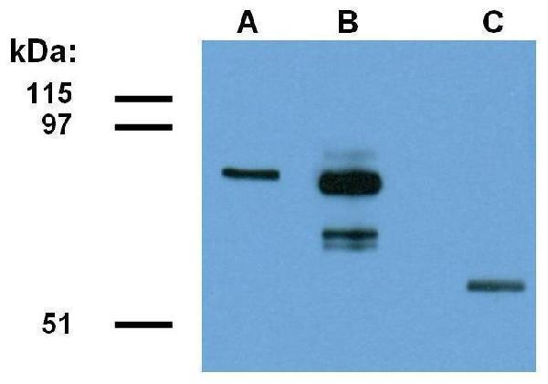 Western blotting detection of ABRA1-EGFP fusion protein in lysate of transfected HEK293 cells