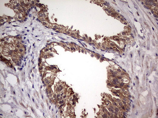m32358 anti ufd1 mouse monoclonal antibody clone id oti8g6 ihc testing 10