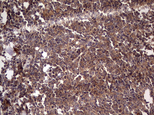 m32358 anti ufd1 mouse monoclonal antibody clone id oti8g6 ihc testing 12