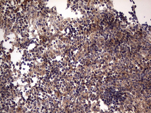 m32358 anti ufd1 mouse monoclonal antibody clone id oti8g6 ihc testing 13