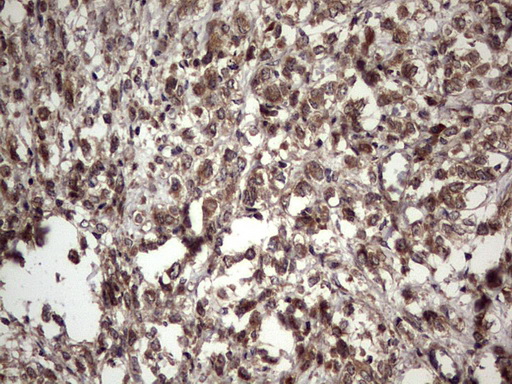 m32358 anti ufd1 mouse monoclonal antibody clone id oti8g6 ihc testing 14