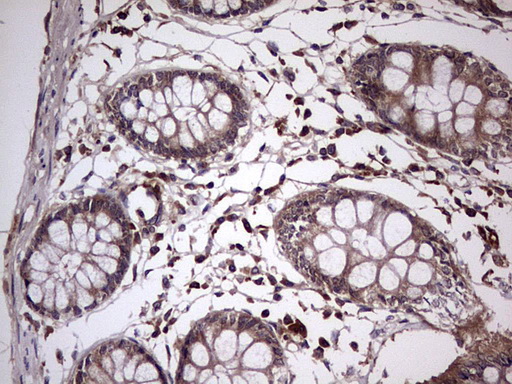 m32358 anti ufd1 mouse monoclonal antibody clone id oti8g6 ihc testing 15
