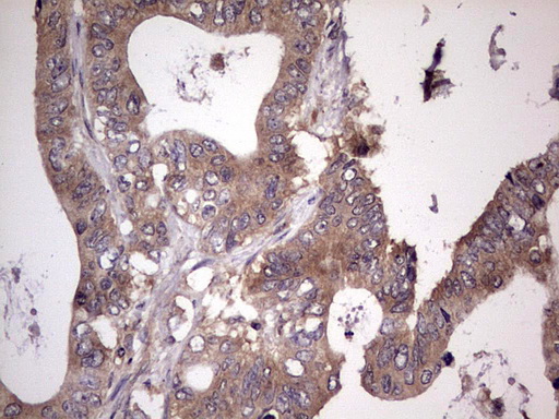 m32358 anti ufd1 mouse monoclonal antibody clone id oti8g6 ihc testing 16